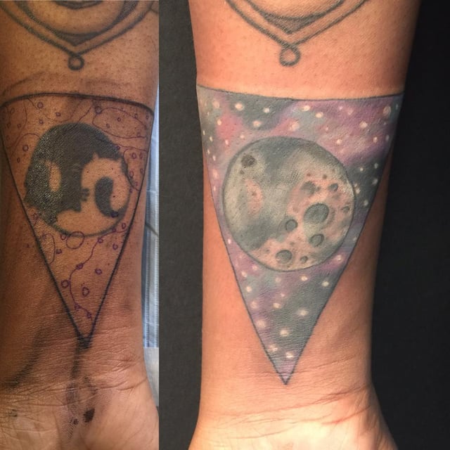 serious issues with at home tattoo removal serious issues with at home tattoo removal